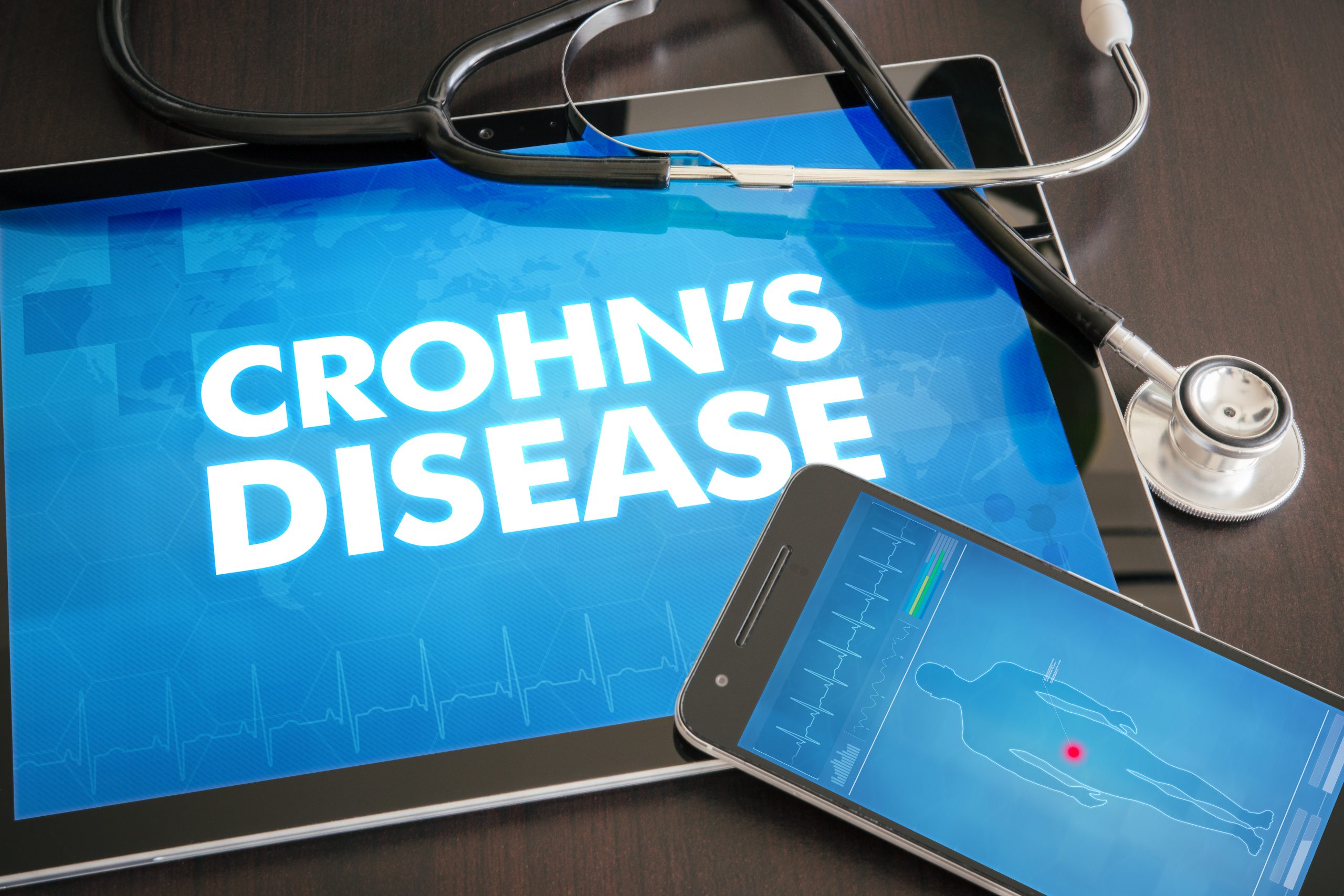 CBD und Morbus Crohn Erkrankung Alice Kilimann Texterin